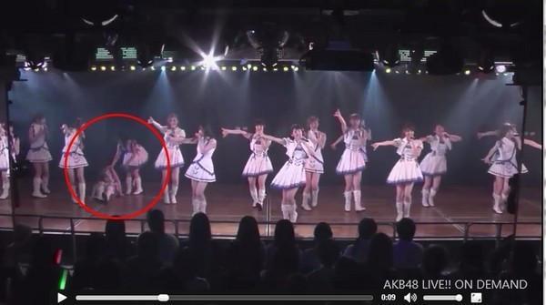 AKB48成员膝盖脱臼