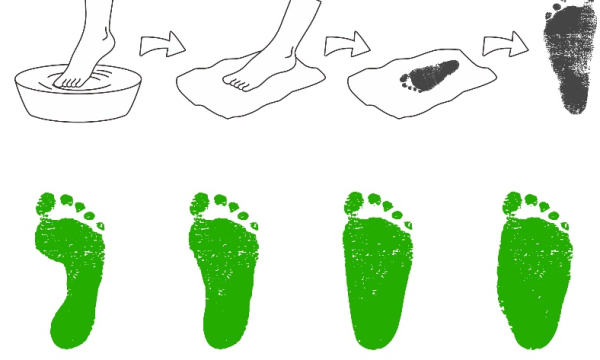 扁平足也能简单自测，矫正鞋则需找靠谱机构定制